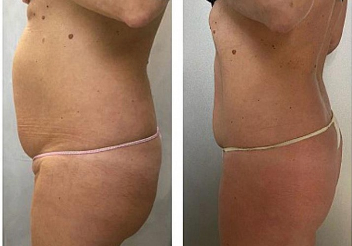 Cambia il tuo corpo in due mesi